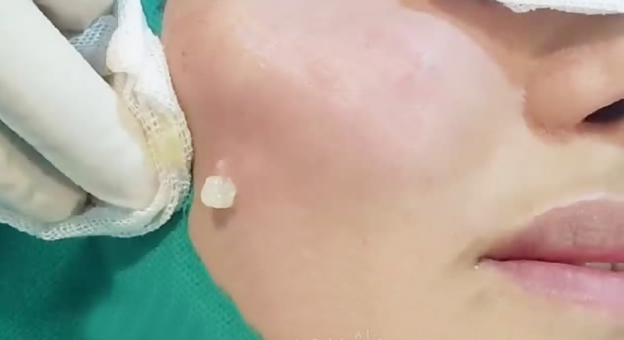 تزریق ژل اورجینال؛ طبیعی، متناسب و ایمن